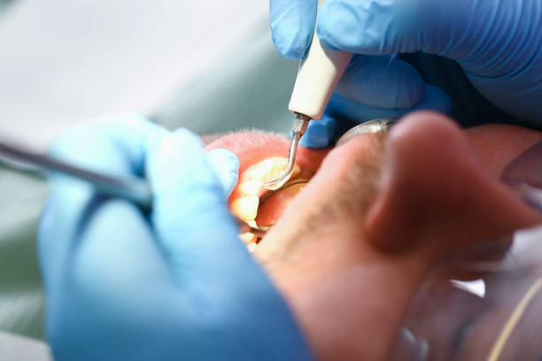 Best Walk-In Emergency Dentist in Martin, TN
