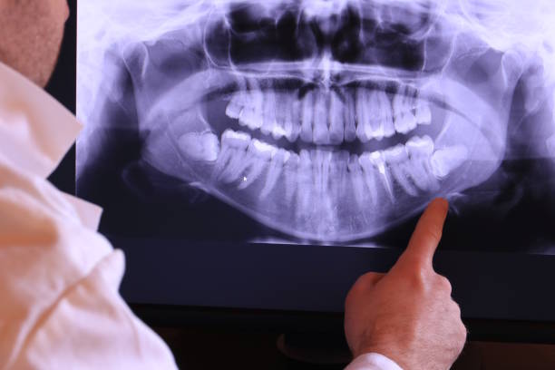 Best Emergency Broken Tooth Repair in Martin, TN