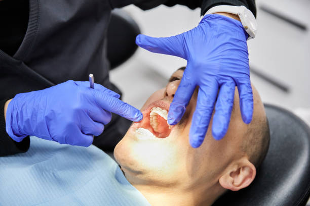 Best Emergency Broken Tooth Repair in Martin, TN